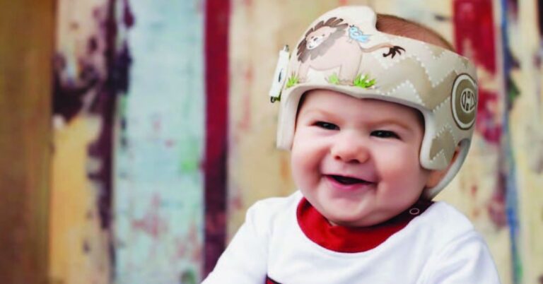 how-much-do-baby-helmets-cost-babycious